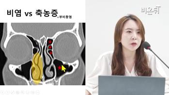 [방송/유튜브 비온뒤] 비염·축농증 치료는 이렇게 - 윤소연 교수